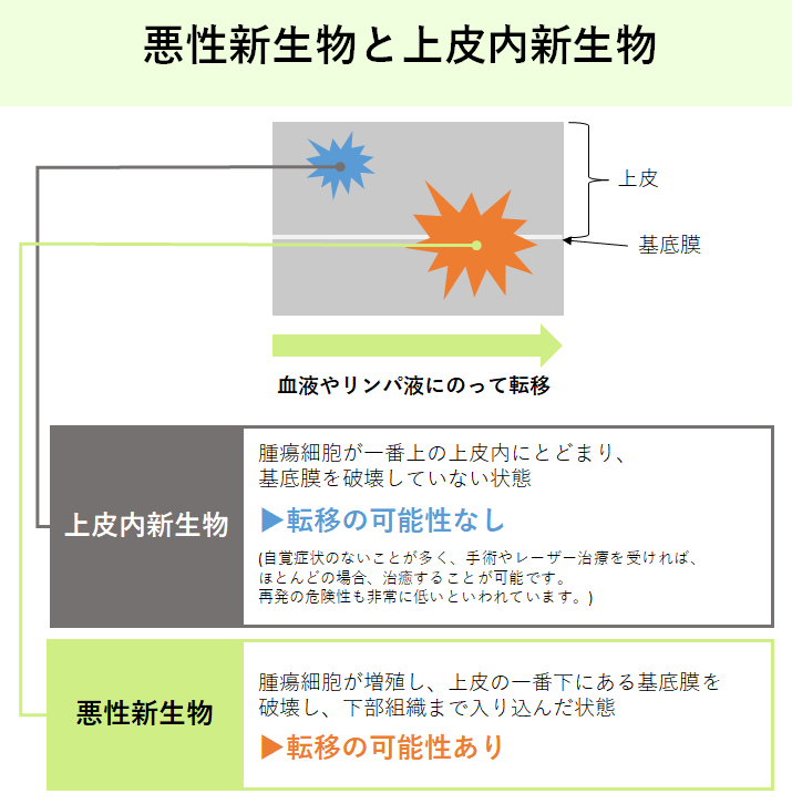 がんの仕組みを知っておきましょう
